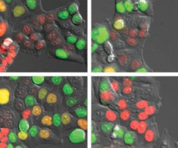 Image: Researchers tracked down mutations in the phosphatase Wip1 in cancer cells that enhance the protein’s ability to shut down p53 and stymie the DNA damage repair process. The panel shows how cells respond to a dose of radiation that normally stops cells from dividing. The top row shows the cells one hour after the radiation, and the bottom row shows them 17 hours afterward. Cells with truncated Wip1 (left column) progress normally toward the point of cell division (orange nuclei), but most cells lacking truncated Wip1 (right column) fail to progress (red nuclei) (Photo courtesy of  Dr. Indra Shaltiel, The Netherlands Cancer Institute).